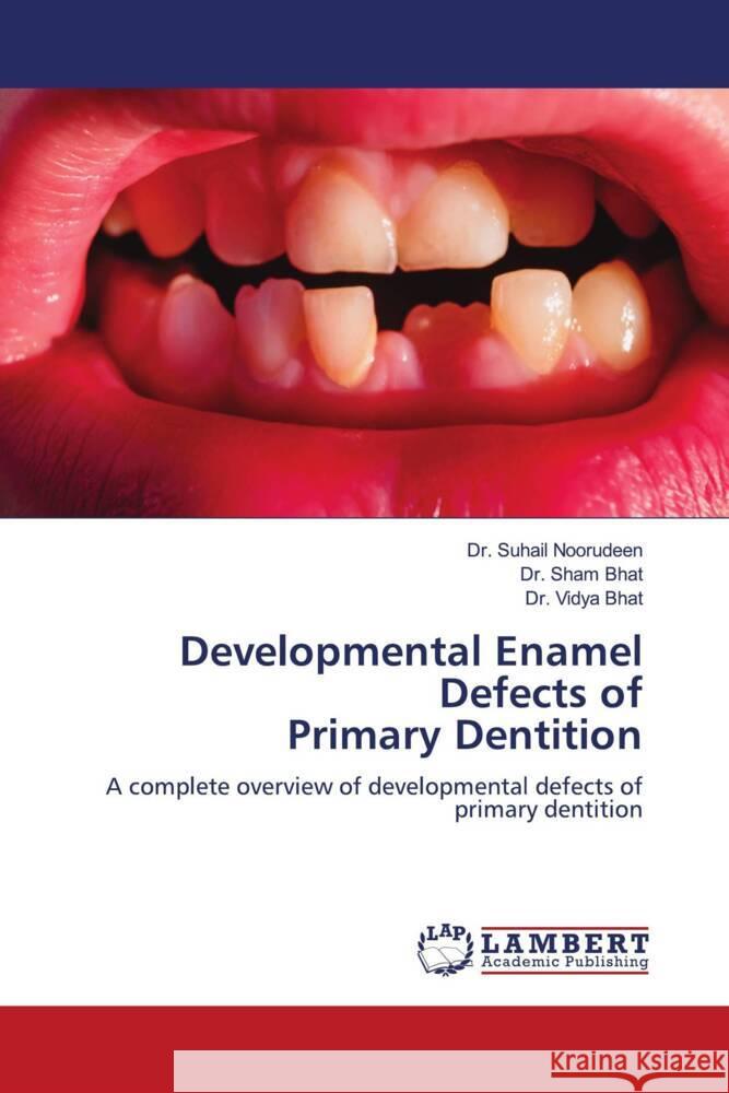 Developmental Enamel Defects of Primary Dentition Noorudeen, Dr. Suhail, Bhat, Dr. Sham, Bhat, Dr. Vidya 9786202787963 LAP Lambert Academic Publishing - książka