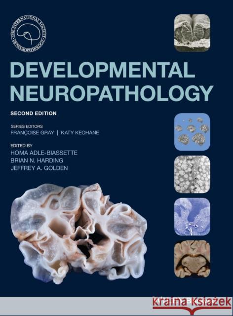 Developmental Neuropathology Homa Adle-Biassette Brian N. Harding Jeffrey A. Golden 9781119013082 Wiley-Blackwell - książka
