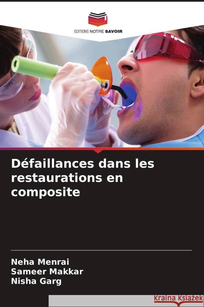 Défaillances dans les restaurations en composite Menrai, Neha, Makkar, Sameer, Garg, Nisha 9786205443064 Editions Notre Savoir - książka