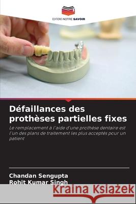 D?faillances des proth?ses partielles fixes Chandan SenGupta Rohit Kumar Singh 9786207552054 Editions Notre Savoir - książka