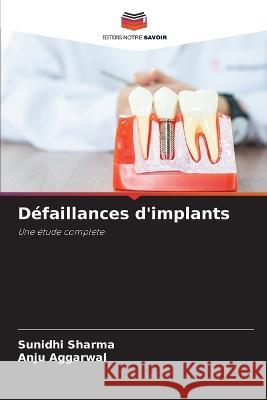 Défaillances d'implants Sunidhi Sharma, Anju Aggarwal 9786205262351 Editions Notre Savoir - książka