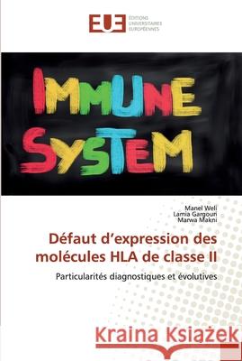 Défaut d'expression des molécules HLA de classe II Weli, Manel 9786139573899 Éditions universitaires européennes - książka