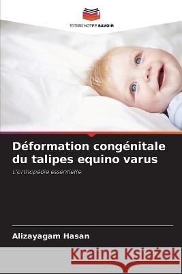 D?formation cong?nitale du talipes equino varus Alizayagam Hasan 9786205606834 Editions Notre Savoir - książka