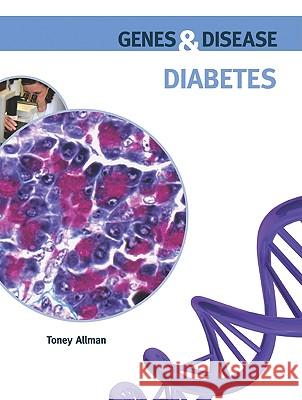 Diabetes Toney Allman 9780791095850 Chelsea House Publishers - książka