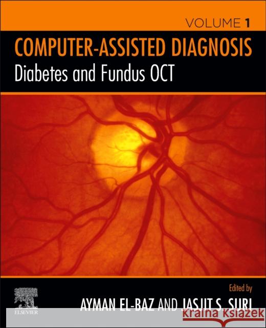 Diabetes and Fundus Oct Ayman S Jasjit S. Suri 9780128174401 Elsevier - książka