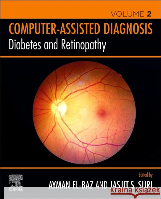 Diabetes and Retinopathy Ayman S Jasjit S. Suri 9780128174388 Elsevier - książka