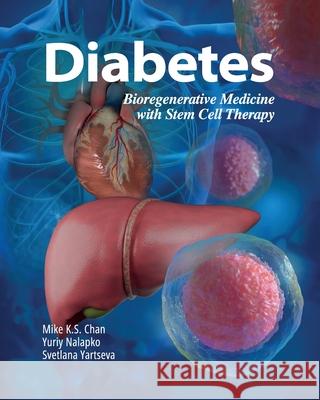 Diabetes: Bioregenerative Medicine with Stem Cell Therapy Mike K. S. Chan Yuriy Nalapko Svetlana Yartseva 9781662968549 European Wellness Academy - książka