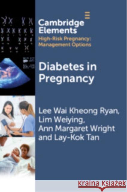 Diabetes in Pregnancy Lay-Kok (KK Women’s and Children’s Hospital, Singapore) Tan 9781009507158 Cambridge University Press - książka