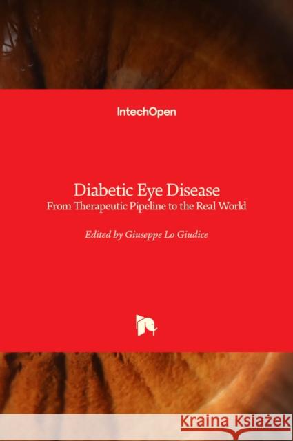 Diabetic Eye Disease: From Therapeutic Pipeline to the Real World Giuseppe Lo Giudice   9781839697647 Intechopen - książka