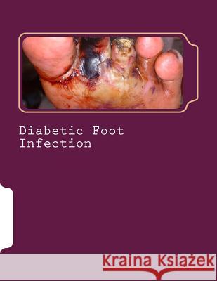 Diabetic Foot Infection Dr Romana Ayub MR Syed Shahmeer Raza 9781519448781 Createspace - książka