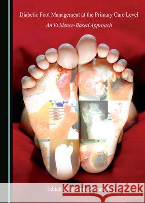 Diabetic Foot Management at the Primary Care Level: An Evidence-Based Approach Hashim Mohamed 9781527555044 Cambridge Scholars Publishing (RJ) - książka