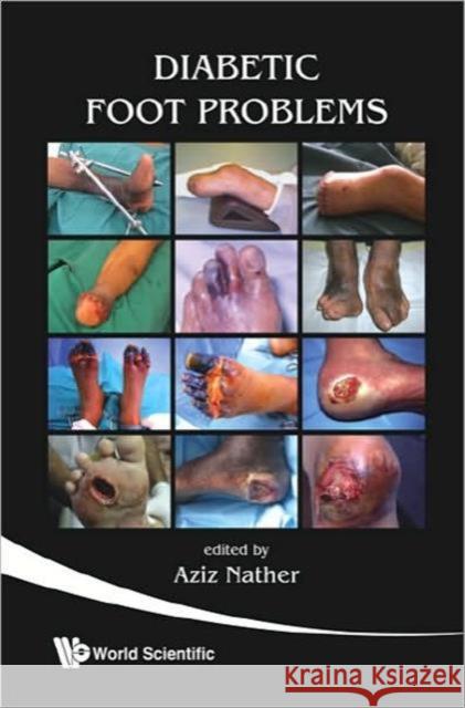 Diabetic Foot Problems Aziz Nather 9789812791511 World Scientific Publishing Company - książka