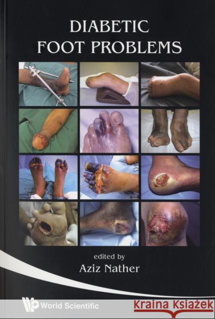 Diabetic Foot Problems Aziz Nather 9789812791528 World Scientific Publishing Company - książka