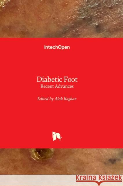 Diabetic Foot: Recent Advances Alok Raghav 9781838808143 IntechOpen - książka