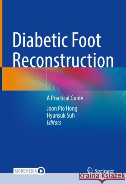 Diabetic Foot Reconstruction: A Practical Guide Hong, Joon Pio 9789811698156 Springer Singapore - książka