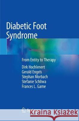Diabetic Foot Syndrome: From Entity to Therapy Hochlenert, Dirk 9783030063542 Springer - książka