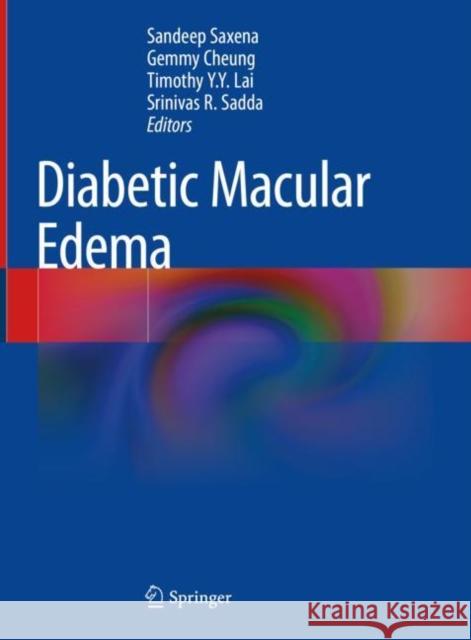 Diabetic Macular Edema Sandeep Saxena Gemmy Cheung Timothy Y. Y. Lai 9789811973062 Springer - książka