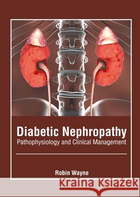 Diabetic Nephropathy: Pathophysiology and Clinical Management Robin Wayne 9781639271146 American Medical Publishers - książka