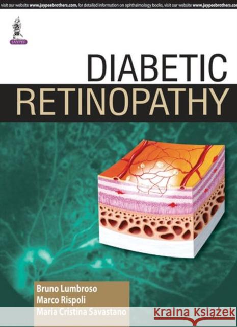 Diabetic Retinopathy Bruno Lumbroso 9789351528982 JP Medical Ltd - książka