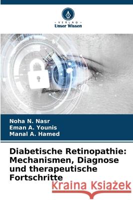 Diabetische Retinopathie: Mechanismen, Diagnose und therapeutische Fortschritte Nasr, Noha N., Younis, Eman A., Hamed, Manal A. 9786208461010 Verlag Unser Wissen - książka