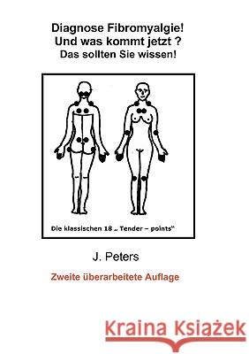 Diagnose Fibromyalgie! Und was kommt jetzt?: Das sollten sie Wissen! Peters, Joachim 9783837092387 Bod - książka