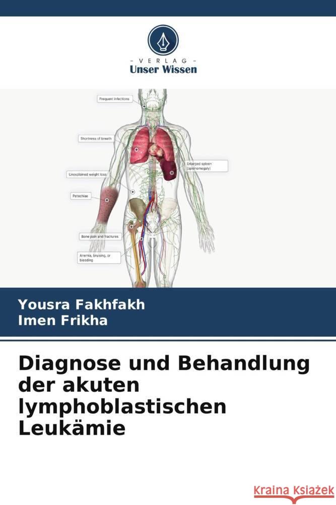 Diagnose und Behandlung der akuten lymphoblastischen Leukämie Fakhfakh, Yousra, Frikha, Imen 9786208184896 Verlag Unser Wissen - książka