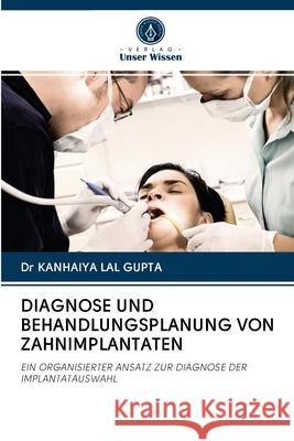 Diagnose Und Behandlungsplanung Von Zahnimplantaten Dr Kanhaiya Lal Gupta 9786202851930 Verlag Unser Wissen - książka