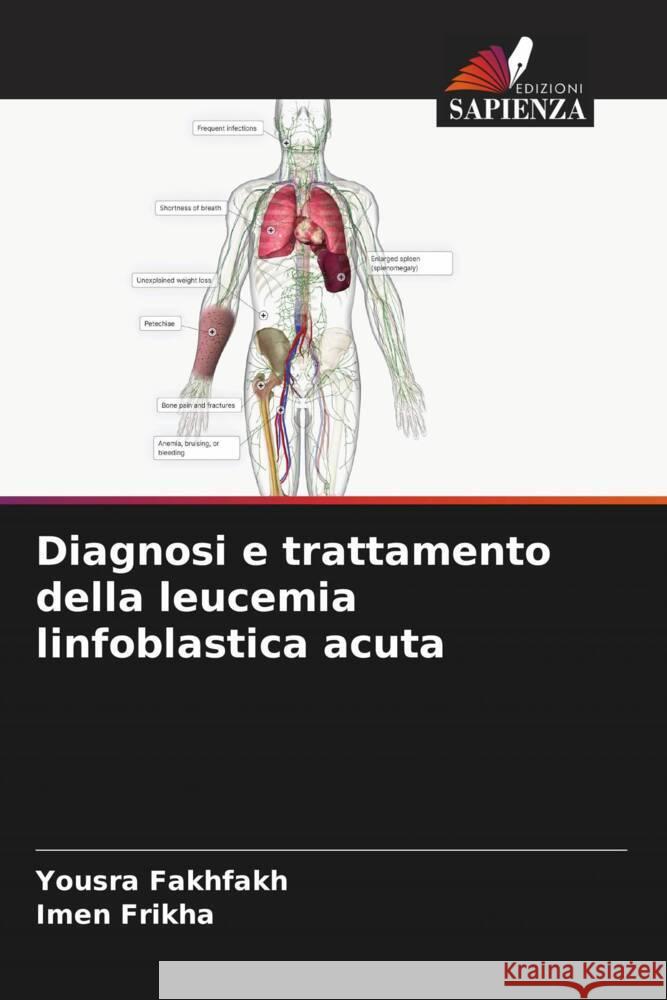 Diagnosi e trattamento della leucemia linfoblastica acuta Fakhfakh, Yousra, Frikha, Imen 9786208184926 Edizioni Sapienza - książka