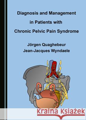 Diagnosis and Management in Patients with Chronic Pelvic Pain Syndrome Quaghebeur J Jean-Jacques Wyndaele 9781527564503 Cambridge Scholars Publishing - książka