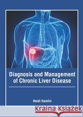 Diagnosis and Management of Chronic Liver Disease Heidi Hamlin 9781632426802 Foster Academics - książka