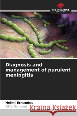 Diagnosis and management of purulent meningitis Ernandes, Helmi, Smaoui, Olfa 9786209110115 Our Knowledge Publishing - książka