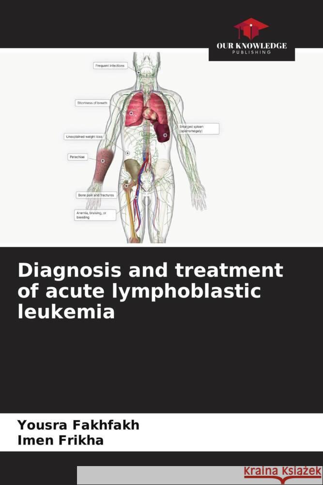 Diagnosis and treatment of acute lymphoblastic leukemia Fakhfakh, Yousra, Frikha, Imen 9786208184902 Our Knowledge Publishing - książka