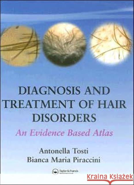Diagnosis and Treatment of Hair Disorders: An Evidence-Based Atlas Antonella Tosti Bianca Maria Piraccini 9781841843407 Taylor & Francis Group - książka