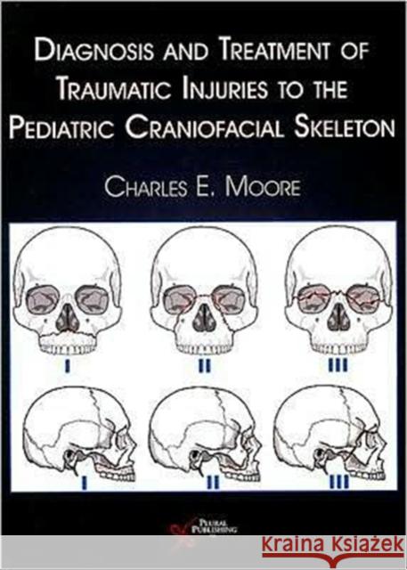 Diagnosis and Treatment of Traumatic Injuries to the Pediatric Craniofacial Skeleton Charles E. Moore 9781597561402 Plural Publishing - książka