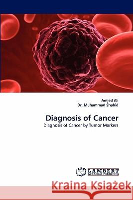 Diagnosis of Cancer  9783844323726 LAP Lambert Academic Publishing AG & Co KG - książka