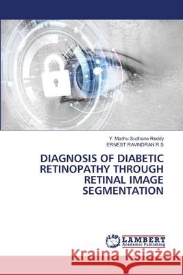 Diagnosis of Diabetic Retinopathy Through Retinal Image Segmentation Y. Madhu Sudhan Ernest Ravindran R 9786207475551 LAP Lambert Academic Publishing - książka