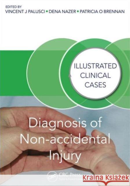 Diagnosis of Non-Accidental Injury: Illustrated Clinical Cases Vincent J. Palusci Dena Nazer Patricia Brennan 9781482230130 Taylor and Francis - książka