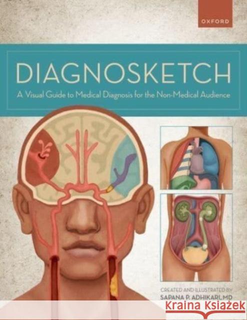 Diagnosketch: A Visual Guide to Medical Diagnosis for the Non-Medical Audience Adhikari, Sapana 9780197636954 Oxford University Press Inc - książka