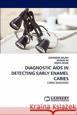 Diagnostic AIDS in Detecting Early Enamel Caries SUDHINDRA Baliga, MUNSHI Ak, DEEPA Hegde 9783844306194 LAP Lambert Academic Publishing - książka