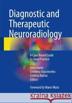Diagnostic and Therapeutic Neuroradiology: A Case-Based Guide to Good Practice Xavier, João 9783319611396 Springer - książka