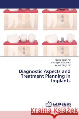 Diagnostic Aspects and Treatment Planning in Implants Pal Atamjit Singh                        Khinda Paramjit Kaur                     Gill Amarjit Singh 9783846532584 LAP Lambert Academic Publishing - książka