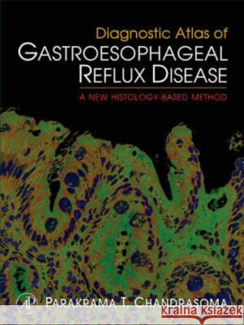 Diagnostic Atlas of Gastroesophageal Reflux Disease: A New Histology-Based Method Chandrasoma, Parakrama T. 9780123736055 Academic Press - książka