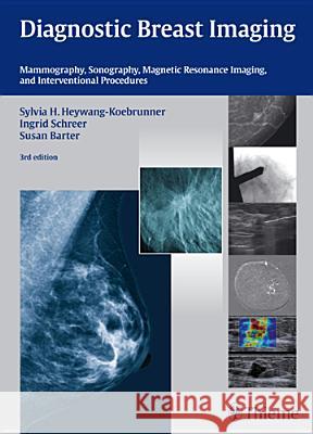 Diagnostic Breast Imaging : Mammography, Sonography, Magnetic Resonance Imaging and Interventional Procedures Sylvia Helen Heywang-Koebrunner Ingrid Schreer Susan Barter 9783131028938 Thieme Medical Publishers - książka