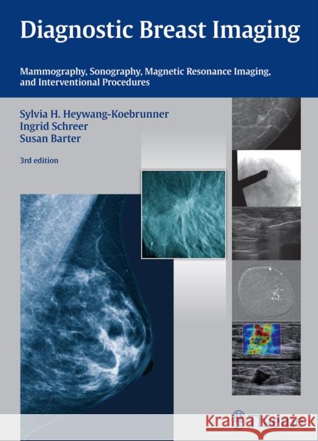 Diagnostic Breast Imaging: Mammography, Sonography, MRI and Interventional Procedures Sylvia H. Heywang-Koebrunner Ingrid Schreer Susan Barter 9783132431928 Thieme Publishing Group - książka