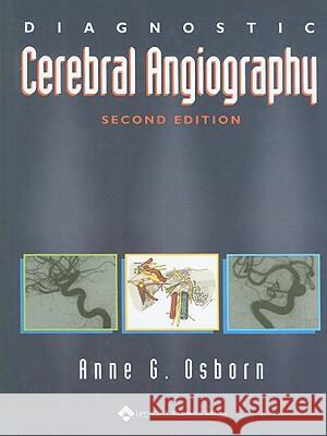 Diagnostic Cerebral Angiography Anne G Osborn 9780397584048 LIPPINCOTT WILLIAMS & WILKINS - książka