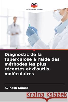 Diagnostic de la tuberculose à l'aide des méthodes les plus récentes et d'outils moléculaires Kumar, Avinash 9786208499167 Editions Notre Savoir - książka