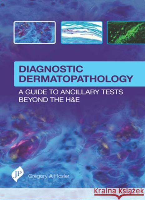 Diagnostic Dermatopathology: A Guide to Ancillary Tests Beyond the H&e Hosler, Gregory 9781909836129 JP Medical Ltd - książka