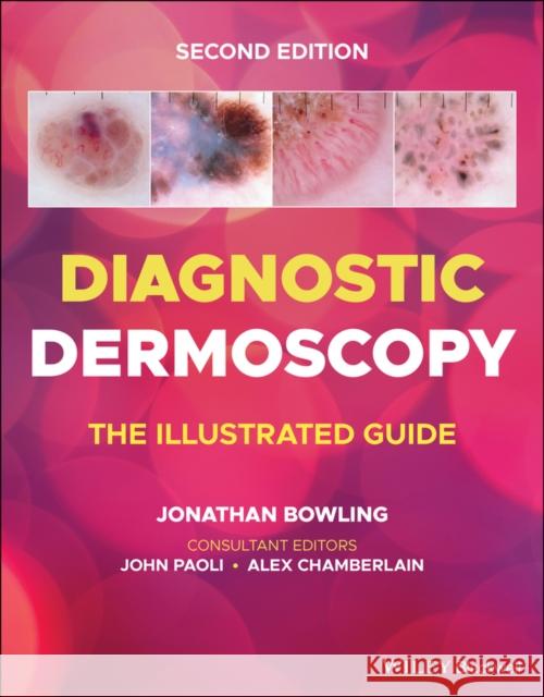 Diagnostic Dermoscopy: The Illustrated Guide Bowling, Jonathan 9781118930489 John Wiley and Sons Ltd - książka