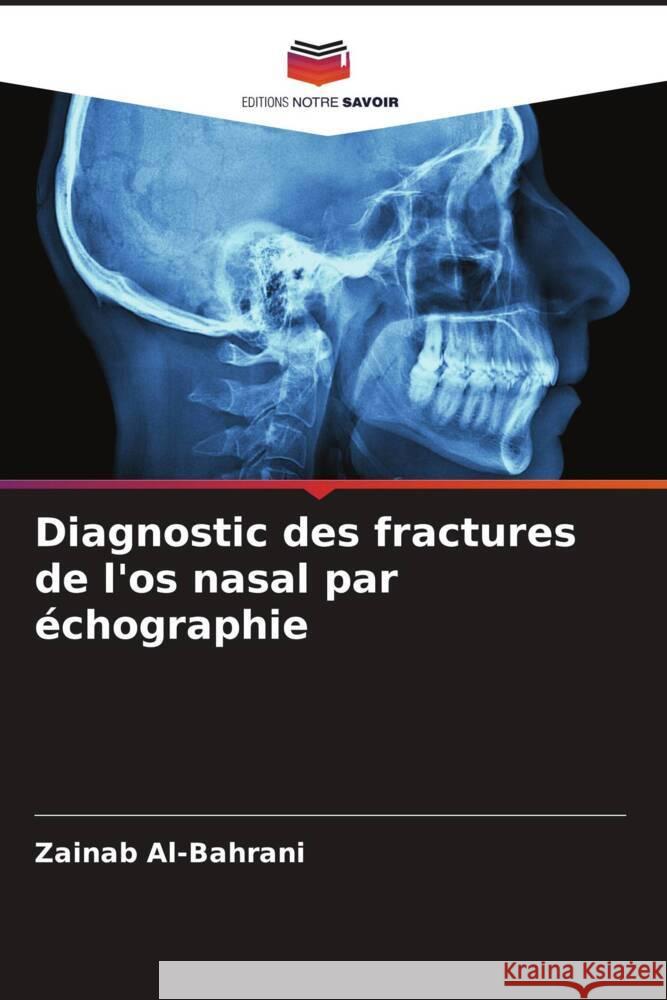 Diagnostic des fractures de l'os nasal par échographie Al-Bahrani, Zainab 9786206449393 Editions Notre Savoir - książka