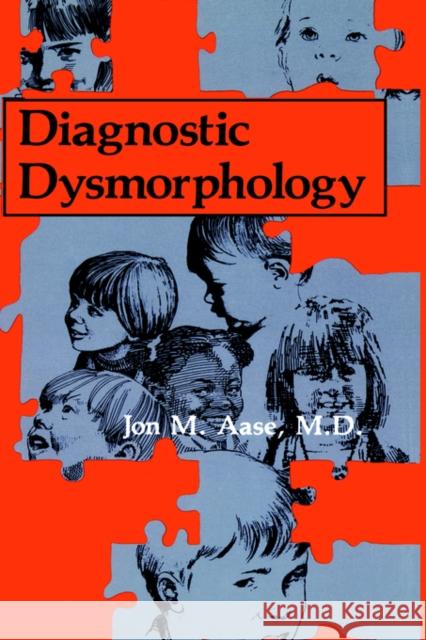 Diagnostic Dysmorphology Jon M. Aase J. M. Aase 9780306434440 Springer - książka